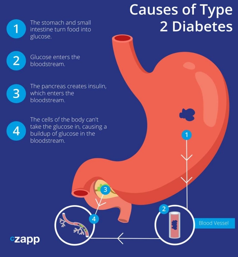 Type 2 diabetes